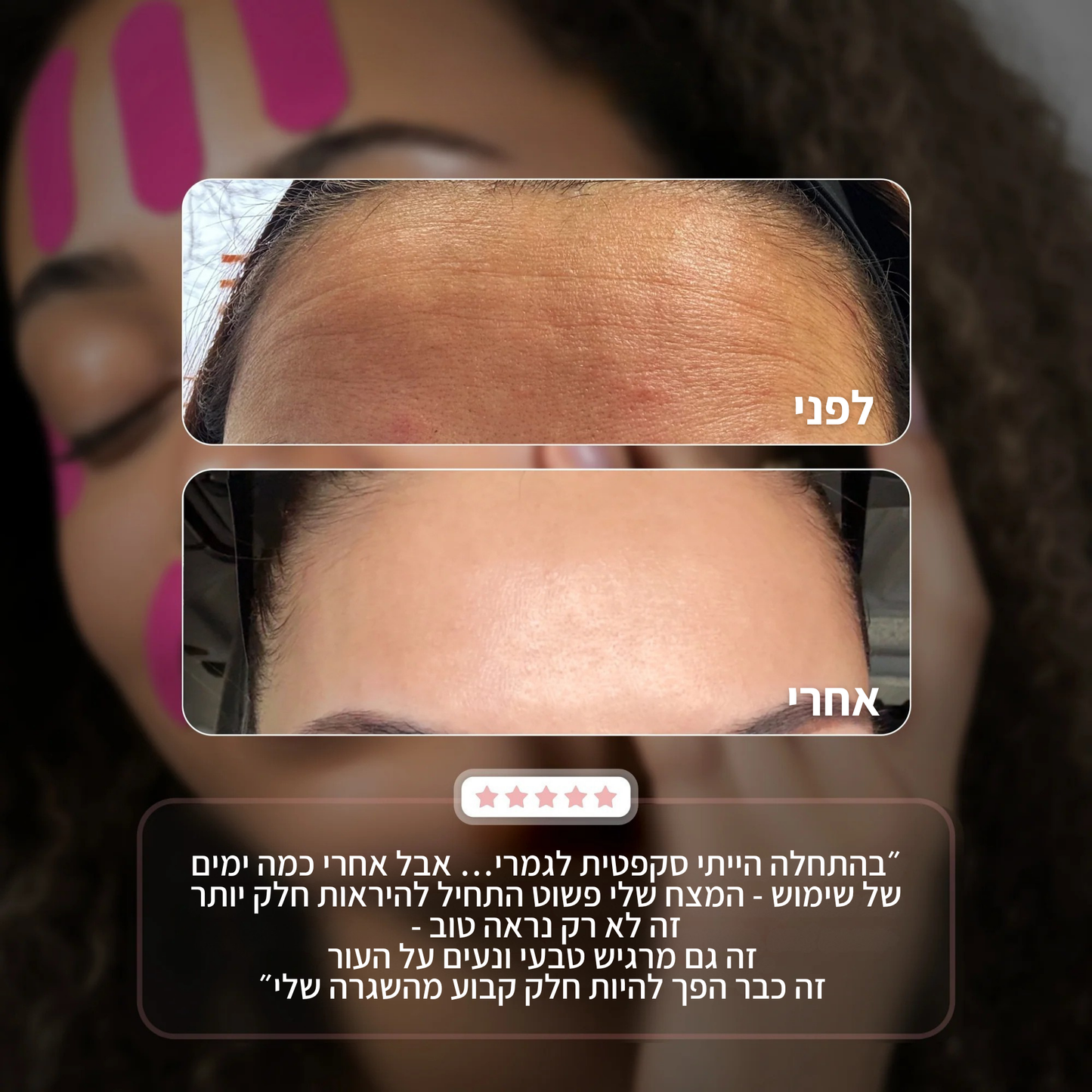 מדבקות ייצוב לקמטים SmoothLine