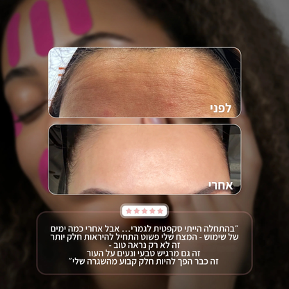 מדבקות ייצוב לקמטים SmoothLine